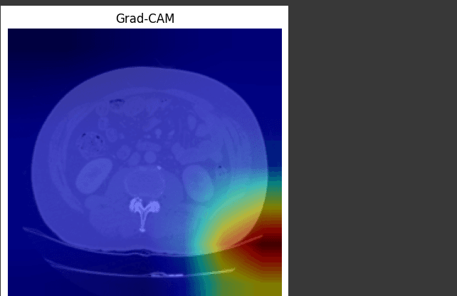 Liver Cancer Detection (Research) preview