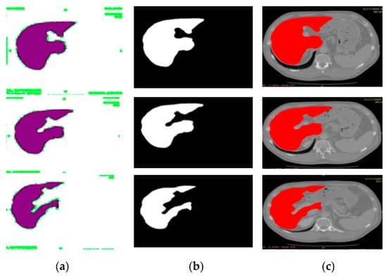 Liver Cancer Detection (Research) preview alt